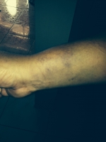 Ex presidente parlamento evaluando keho contra agresion manifestacion