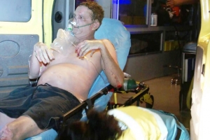 Explosion di gas na Calbas cu herido