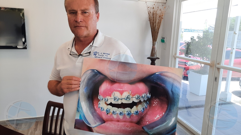 Dentista Marsman ta denuncia dos dentista cuestionabel trahando como orthodontista