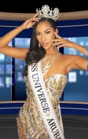Miss Universe Aruba Karol Croes riba cambionan den Miss Universo y cirugia plastico