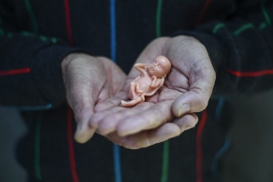 Trouw: Aruba ta actua mas estricto contra aborto, hasta den caso di violacion