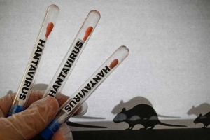 DVG: No tin motibo di preocupacion pa Aruba relaciona cu Hantavirus