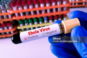 DVG ta monitor brote di Ebola, pero no tin caso na Aruba