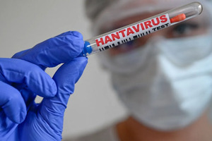 Tres persona muri na Venezuela despues di contagio cu hantavirus